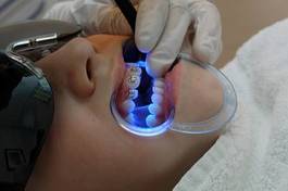 Fotoroleta zdrowie medycyna usta dziewczynka dzieci