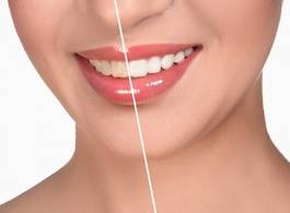 Plakat usta zdrowie uśmiech piękny szminka