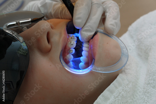 Fototapeta zdrowie medycyna usta dziewczynka dzieci