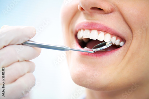 Fotoroleta Zdrowe zęby